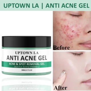 Anti Acne Gel for Acne Prone Skin and Acne Scars Marks with Niacinamide and Salicylic Acid | Anti Acne Face Treatment for Dark Spots | 50 ml